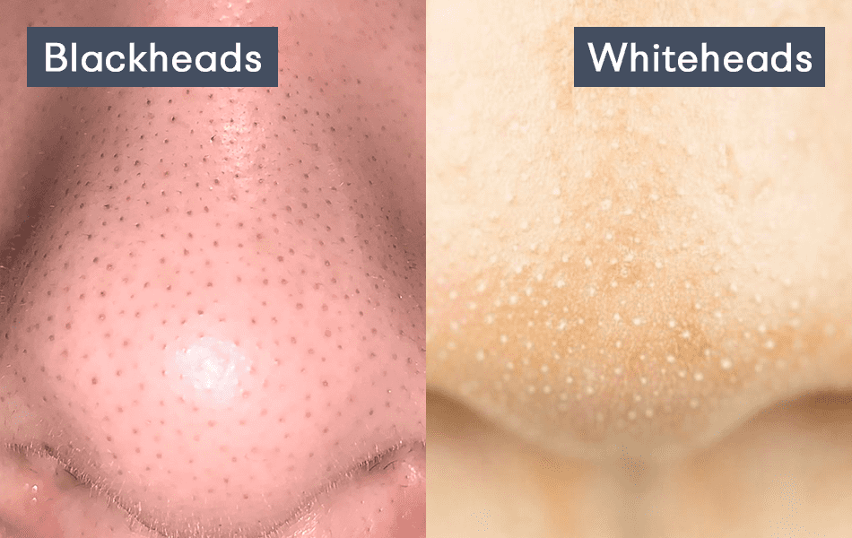 Black&White heads